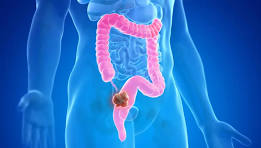 Cirugía colorrectal